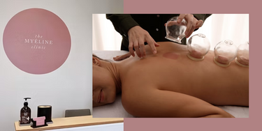 Cupping Therapy Treatment Session with The Myéline Clinic - Hero Image